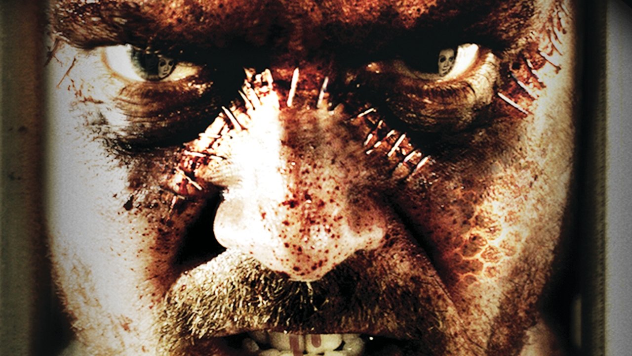Синдром Франкенштейна (фильм, 2010)